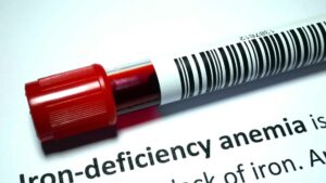 Gallbladder Disease and Iron Deficiency