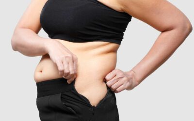 Weight Gain After Gallbladder Removal